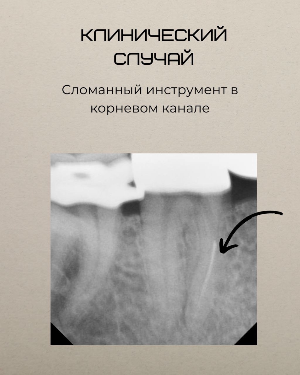 Клинический случай Клинический случай