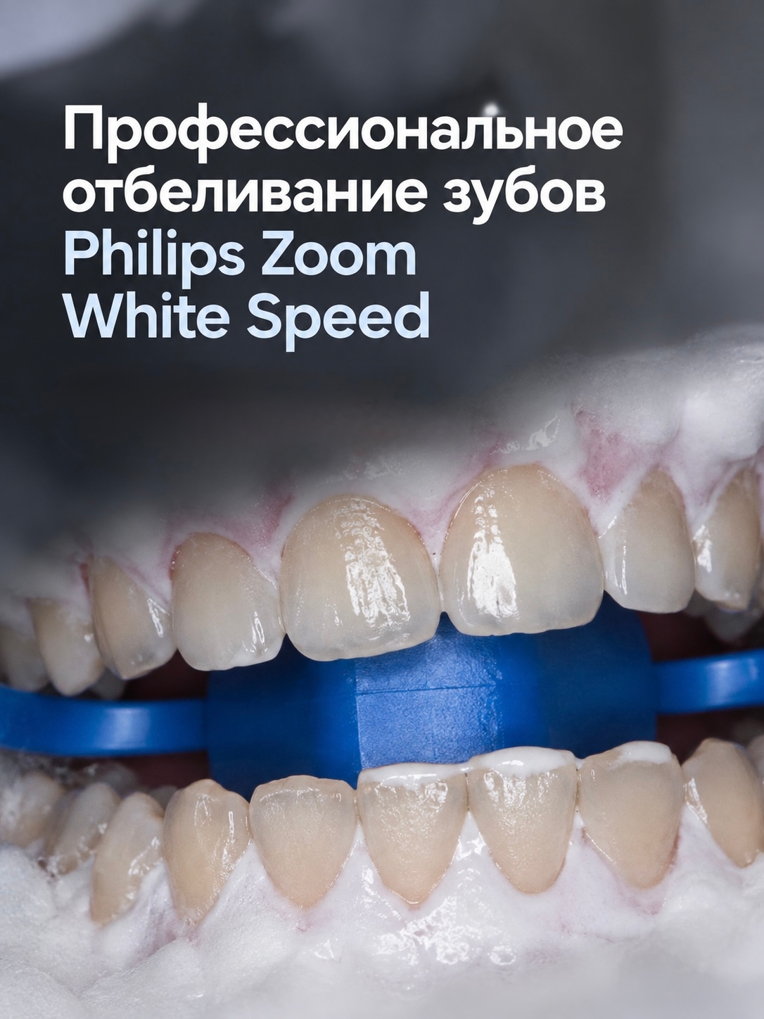 Профессиональная система отбеливания Philips Zoom White Speed