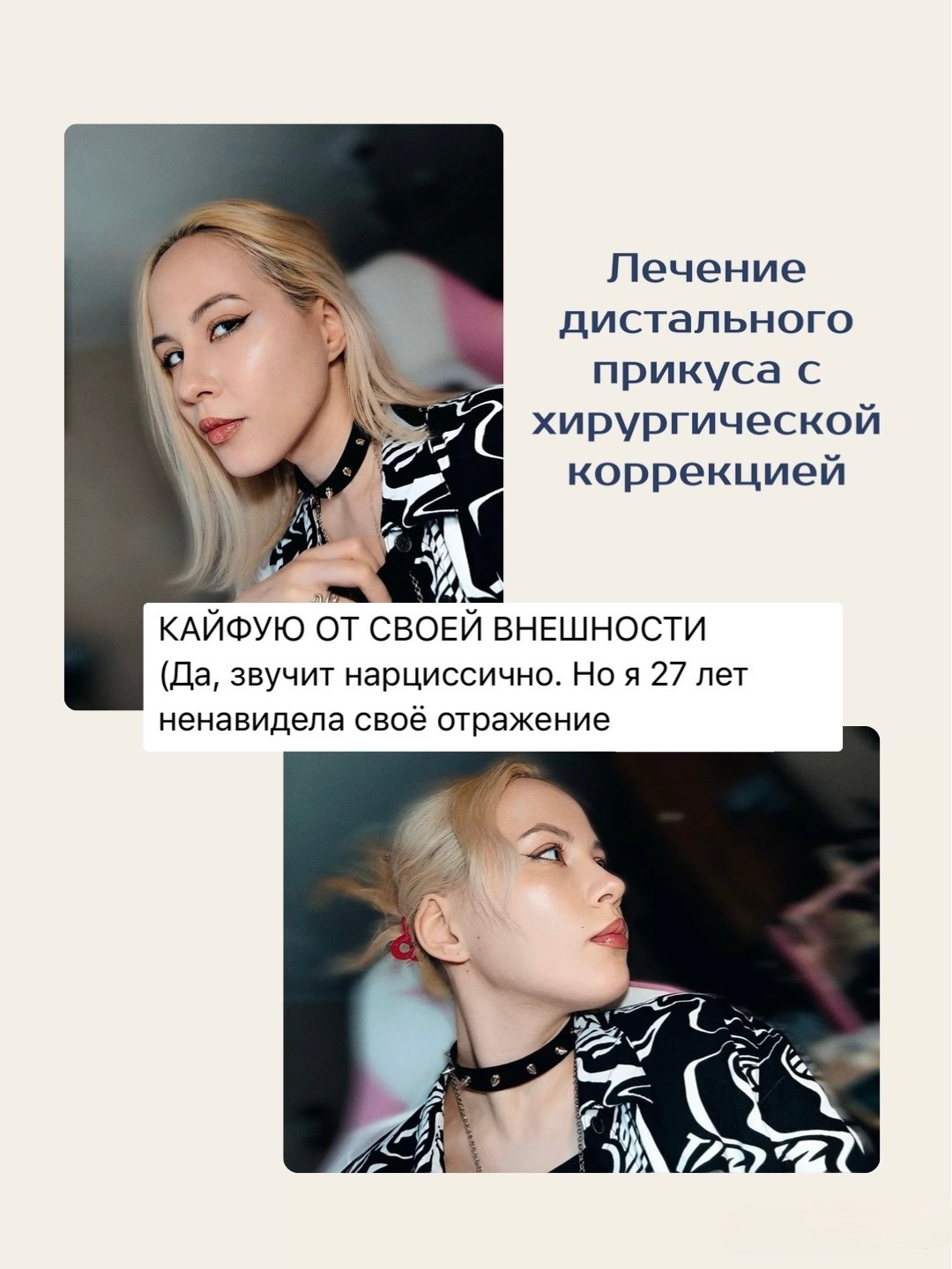 Когда брекетов недостаточно?
