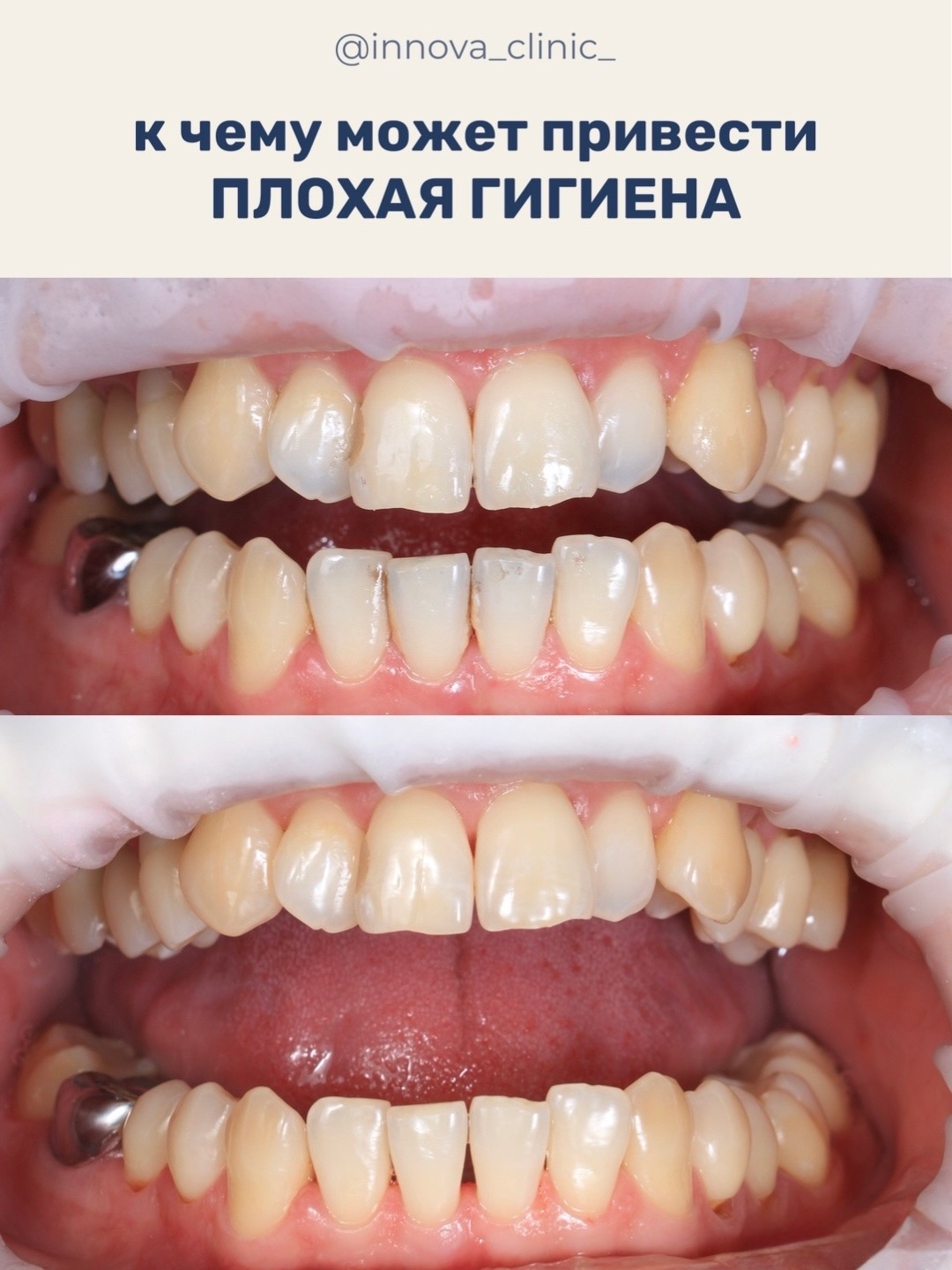К чему может привести плохая гигиена
