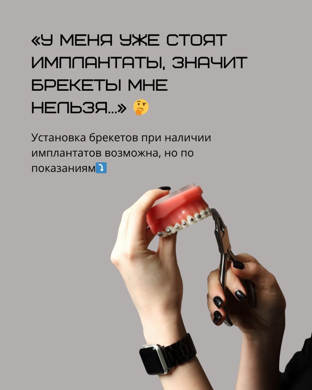 Исправление положения фронтальных зубов после имплантации моляров