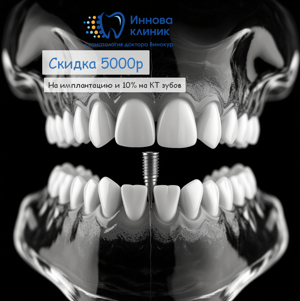 Cкидка 5000 ₽ на имплантацию по промокоду "ИМПЛАНТ" и 10% на КТ зубов