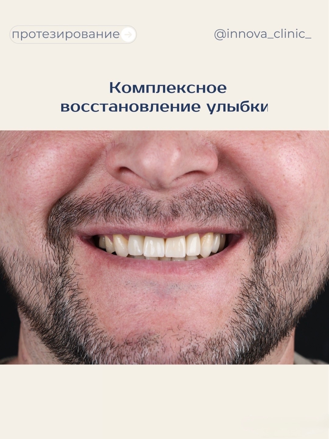Комплексное восстановление улыбки