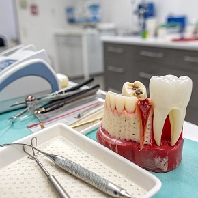 Что такое свищ на десне