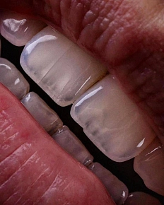 Возможно ли сохранить молодость зубов до 60 лет?