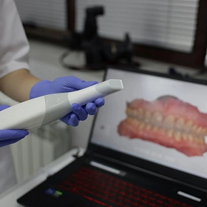 Интраоральный  3D сканер