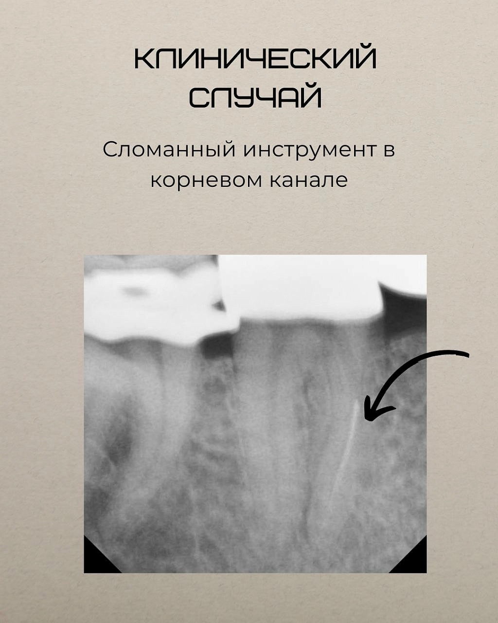 Клинический случай