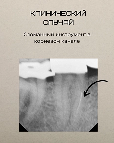 Клинический случай