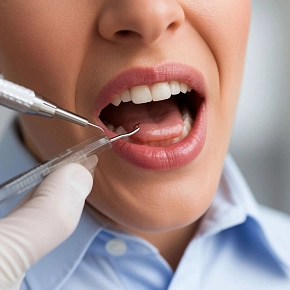 Что такое кариес зубов