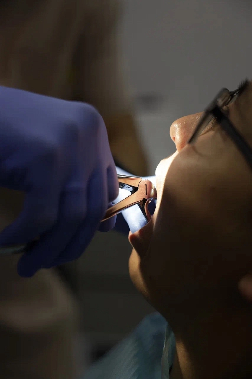 Что происходит после удаления зуба