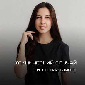 Гипоплазия эмали: это не приговор!