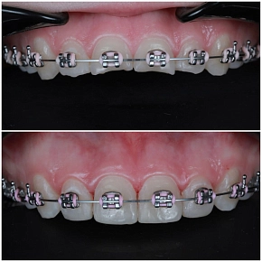 Клинический случай