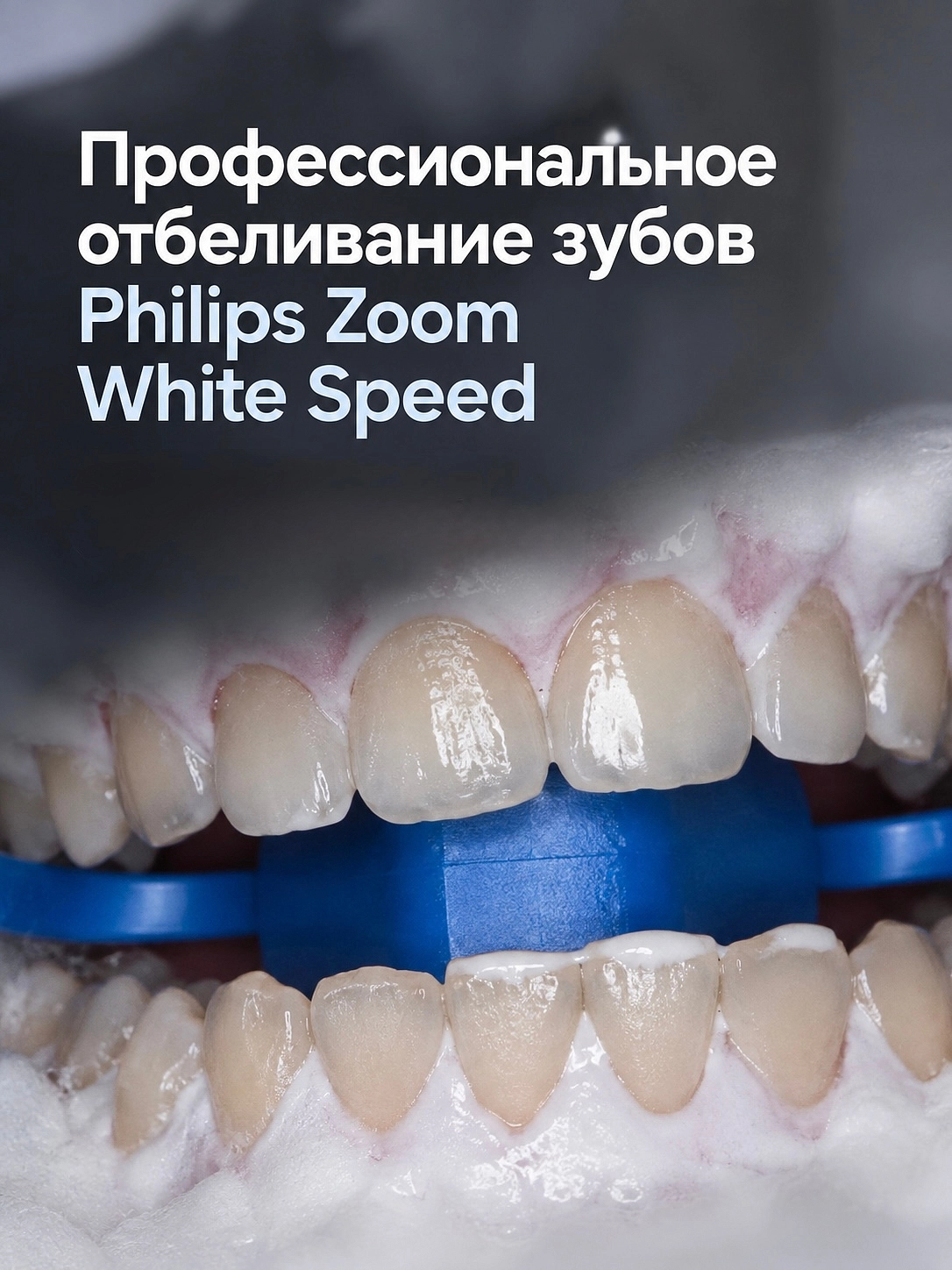 Профессиональная система отбеливания Philips Zoom White Speed