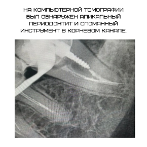 Микроскоп — это настоящая суперсила стоматолога