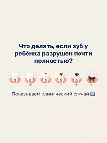 Что делать если зуб у ребенка разрушен почти полностью?