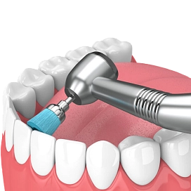 Профессиональная гигиена у детей фото