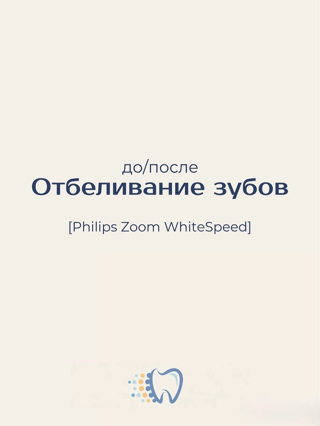 Белоснежная улыбка — это уверенность