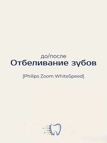 Белоснежная улыбка — это уверенность