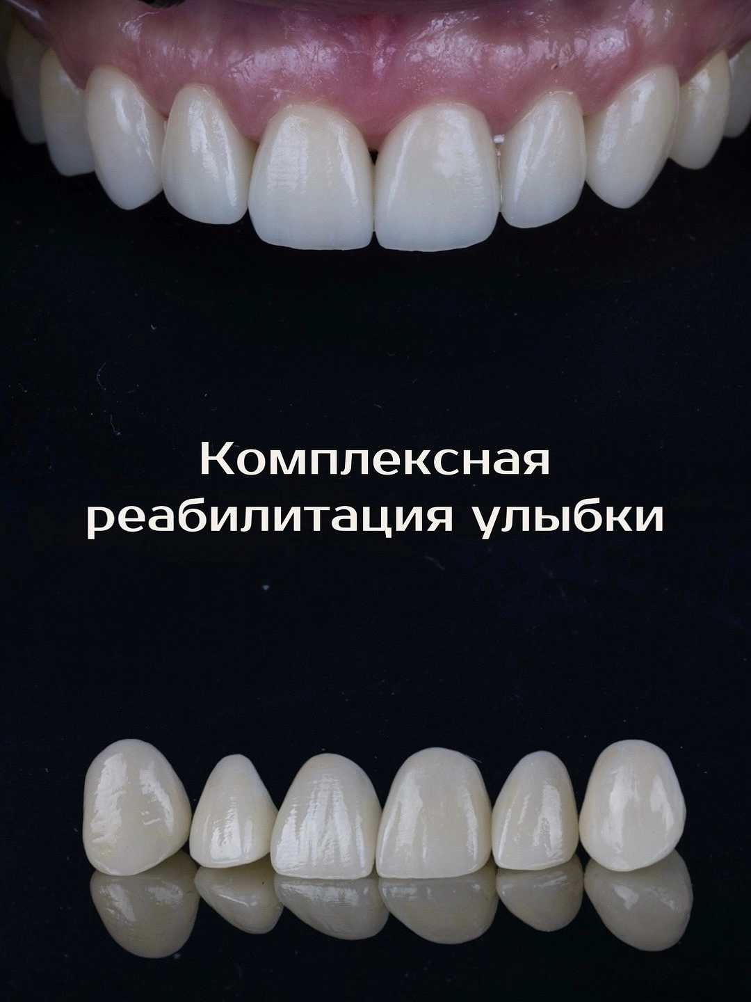 Комплексная реабилитация улыбки