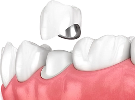 Коронки фото