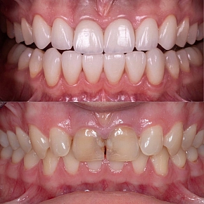 Очередное До/После