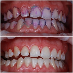 Заботьтесь о своих зубах