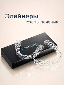 Как проходит лечение на элайнерах