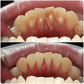  Специальное предложение