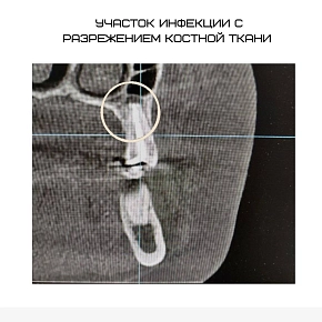 Эндодонтия — это не просто залечивание корневого канала.