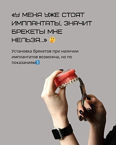 Исправление положения фронтальных зубов после имплантации моляров