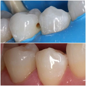 Важность своевременного профилактического осмотра