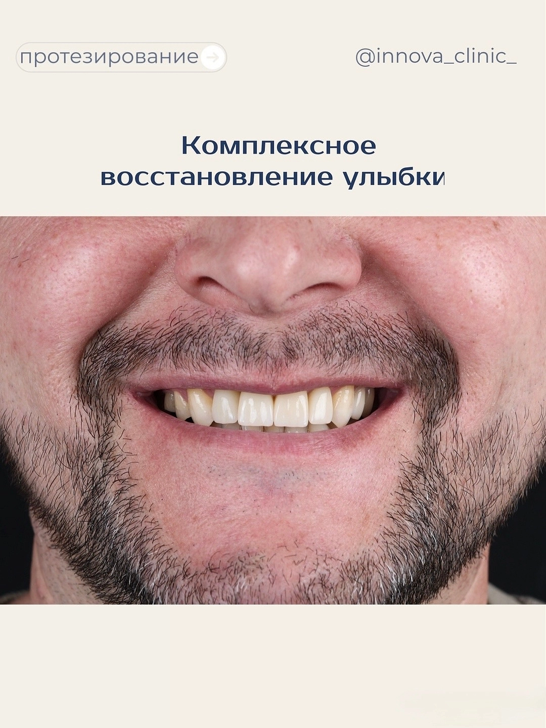 Комплексное восстановление улыбки