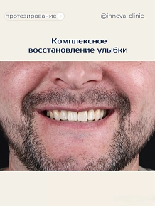 Комплексное восстановление улыбки